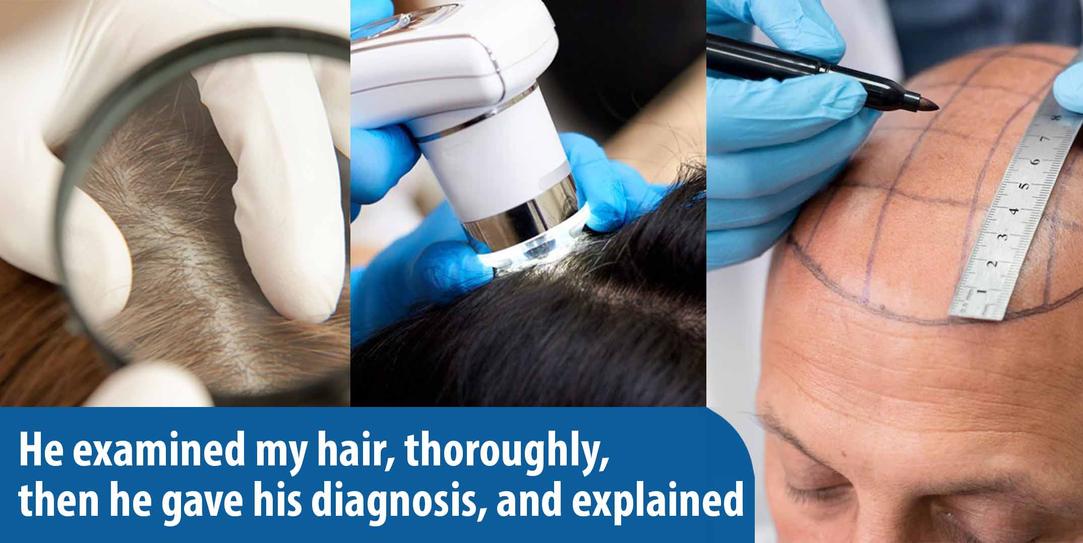 dr ruz hair transplant slider photo 23