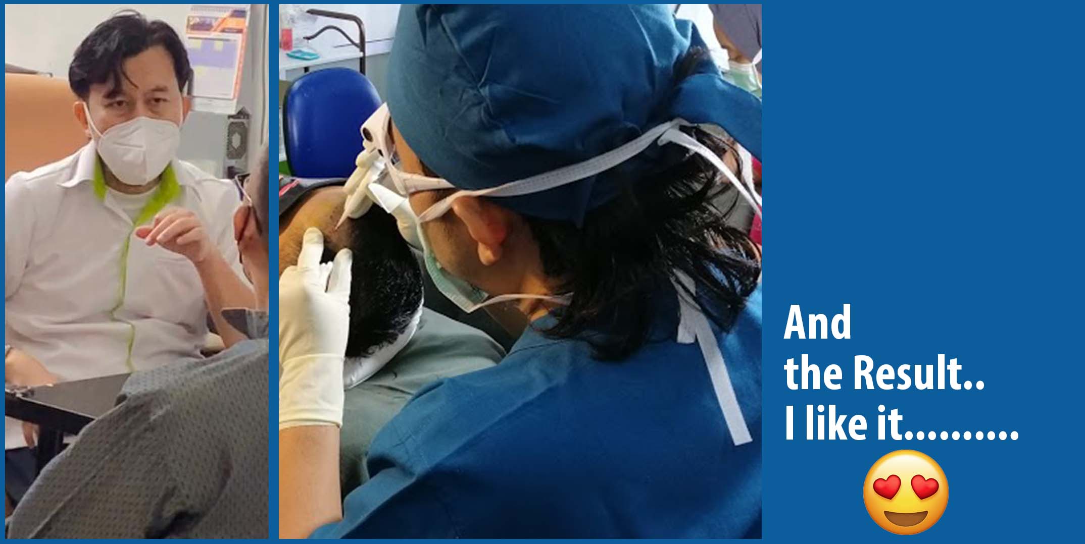 dr ruz hair transplant slider photo 26