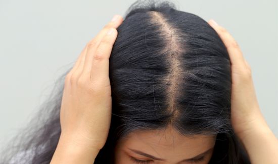 Stressed woman experiencing hair loss, touching thinning hair and looking tired after unsuccessful hair treatment.