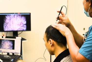 Patient attending consultation, hair examination, and pre-transplant blood testing to schedule hair transplant.